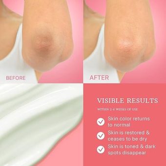 essenlis dark spot remover for face, body, underarms, armpit, knees, elbows, sensitive area, dark spot corrector for women and men, hyperpigmentation treatment, acne spot treatment, freckle remover baby