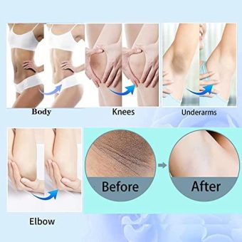 body intimate area dark remover for underarms skin corrector cream