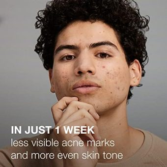 neutrogena stubborn marks pm treatment retinol serum