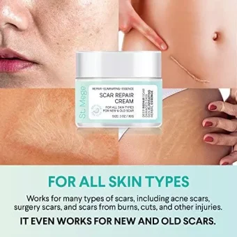 scar removal cream, scar cream for old scars stretch mark removal cream for men & women stretch marks relief and burns repair, face skin repair cream