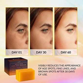 valitic kojic acid dark spot remover soap bars with vitamin c, retinol, collagen, turmeric original japanese complex infused with hyaluronic acid, vitamin e, shea butter, castile olive oil (2 pack) beauty & personal care