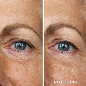 wunderbrow wunderlift, 60 second wrinkle reducer, under eye cream, makeup, vegan and cruelty free (one size)