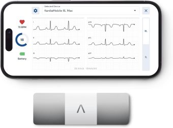 alivecor kardiamobile 6l max – personal 6 lead ekg heart rate monitor with 1 year membership